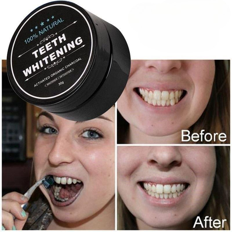 1 Kotak Bubuk Pemutih Gigi Ara - Teeth Whitening Pens ulasan dan harga