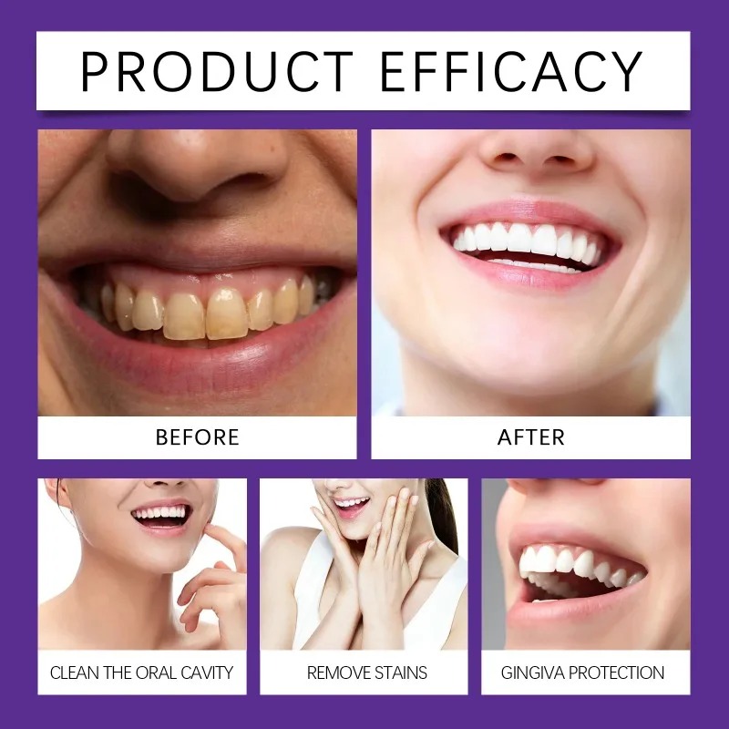 Bubuk Mineral Restorasi Gigi U - Teeth Whitening Near Me ulasan dan harga
